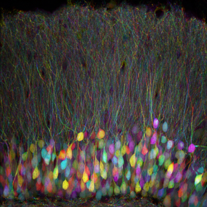 Mouse hippocampus neurons.
