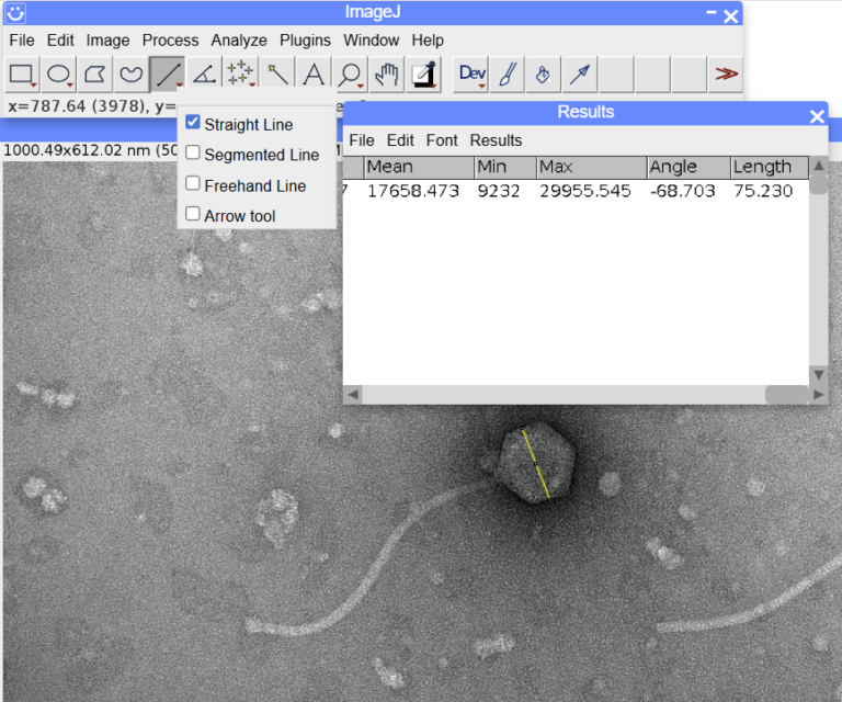 Morphometric Analysis – Keith R. Porter Imaging Facility – UMBC